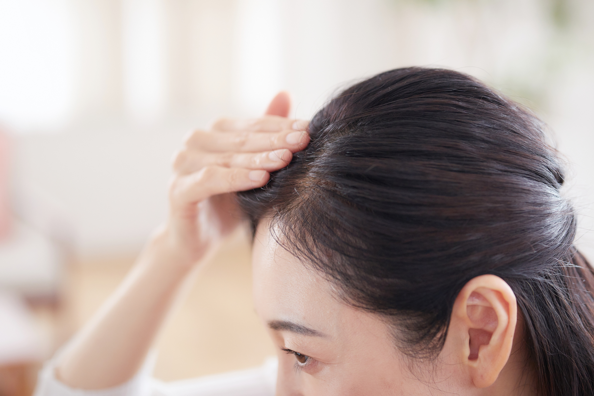 女性薄毛治療(FAGA)