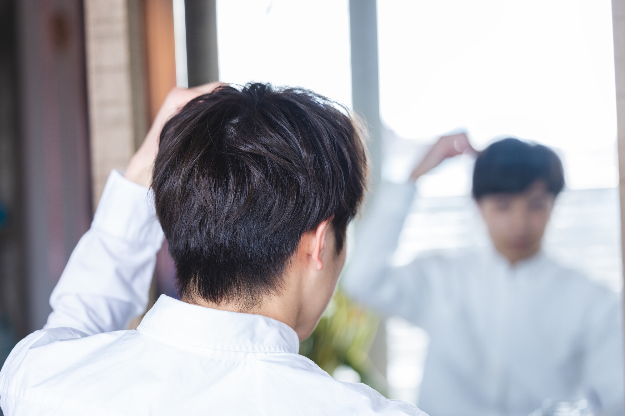 男性薄毛治療(AGA)